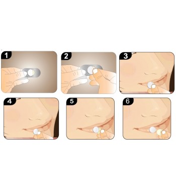 Pharmacoll spots, plasturi antiherpes